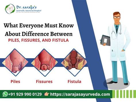 Difference Between Piles Fissure And Fistula | A Listly List