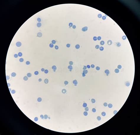 Reticulocytes is Red Blood Cell Immature Stock Image - Image of circle, laboratory: 304213557