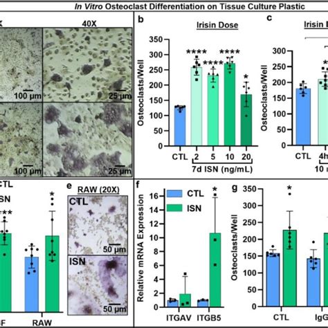 The relationship between osteocyte markers and bone mineral density or... | Download Scientific ...