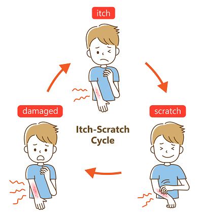 Itch Scratch Cycle Cute Young Man Illustration Dry Dermatitis And ...