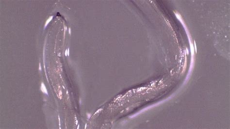 This eye worm, once only found in livestock, is cozying up to humans / Boing Boing