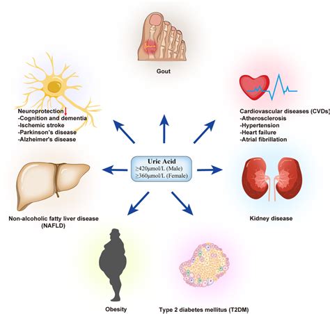 Overview of the identified metabolic diseases associated with hyperuricemia | Download ...