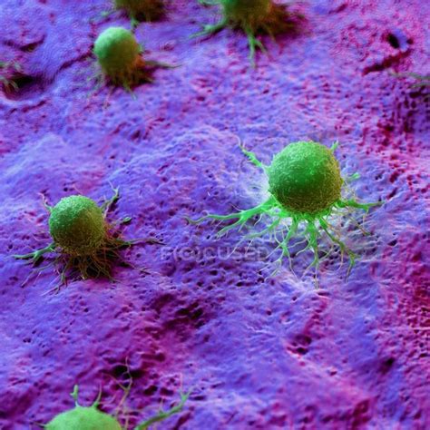 Abstract green colored cancer cells on tissue, digital illustration. — medicine, medical - Stock ...