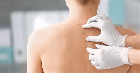 Skin Bumps and Lumps: What Do They Mean? - Scripps Health