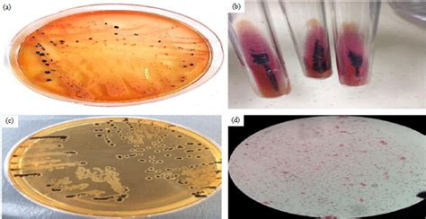 Salmonella Agar Tsi - Kligler S Iron Agar Kia Principle Procedure And ...