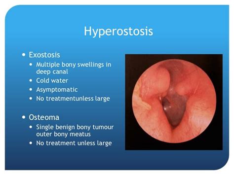 Ear disease presentation (manchester g ps)