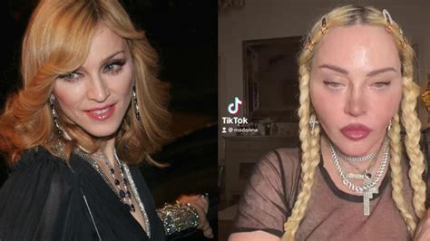 Reddit: Madonna’s Plastic Surgery in 2022 Includes Implants & Facelifts ...