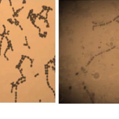 Microscopic appearance of bacterial isolates (a) Cocci and (b) Bacilli... | Download Scientific ...