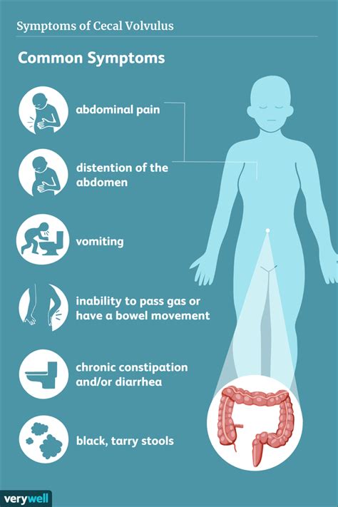 Volvulus: Symptoms, Causes, Diagnosis, and Treatment