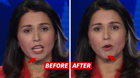 Rep. Tulsi Gabbard's Disappearing Blemish