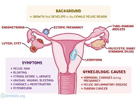 Adnexal Mass: What Is It, Causes, Treatment, and More | Osmosis