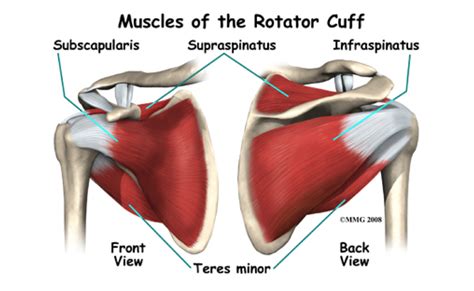 Croydon Physio - Rotator Cuff Tear