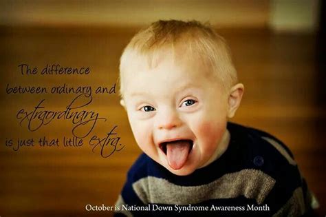 Down syndrome awareness | Down syndrome awareness, Down syndrome, Down syndrome awareness month