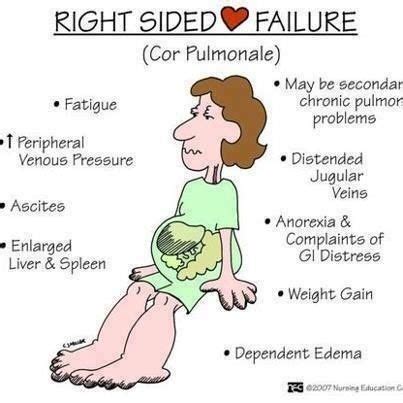 Cor Pulmonale mnemonic - Google Search | Nursing mnemonics, Nursing ...