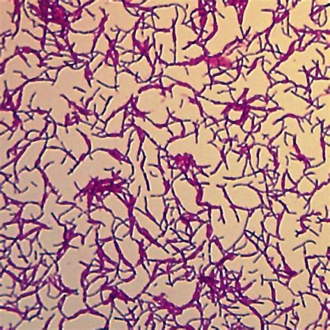 Bacillus megaterium (Typical Bacillus), w.m. Microscope Slide | Carolina Biological Supply