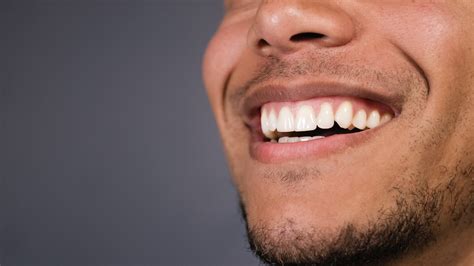 Smokers Teeth Before And After