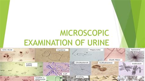 Microscopic Examination of Urine - YouTube