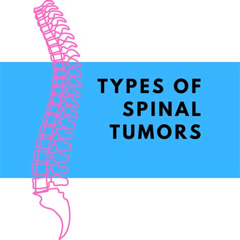 Types Of Spinal Tumors | New Jersey | Comprehensive Spine Care