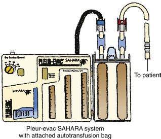 Autotransfusion | Anesthesia Key