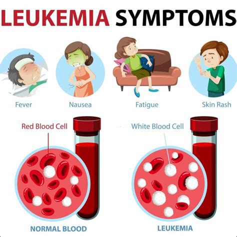 Leukemia Symptoms