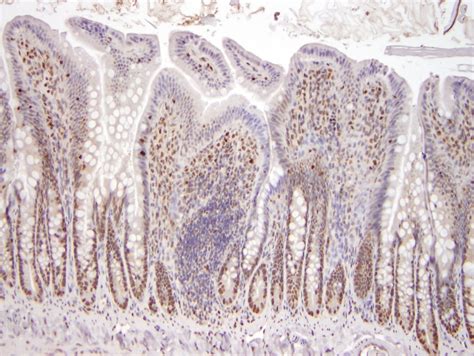 Immunohistochemistry « Tufts Comparative Pathology Services