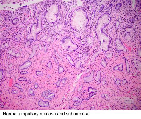 Pathology Outlines - Histology-ampulla