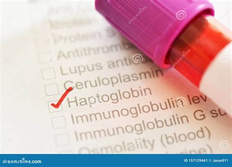 Blood Sample Tube for Haptoglobin Test Stock Image - Image of damage, hematocrit: 157129461