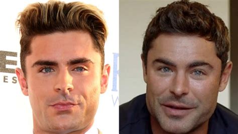 Zac Efron reveals what led to plastic surgery rumors after viral photos