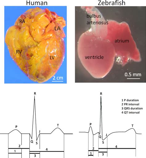 In Vivo Surface Electrocardiography for Adult Zebrafish