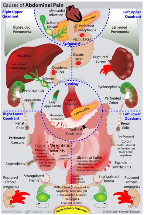 Abdominal Pain - Symptoms & Causes