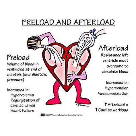 Pin on Cardiac Nursing