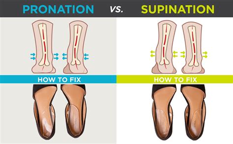 Medial & Lateral Heel Wedge Inserts for Overpronation or Supination ...