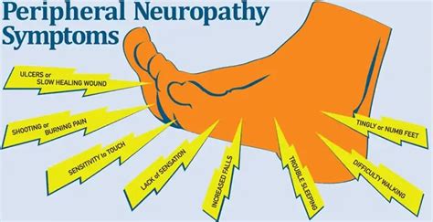 New Advancements in Peripheral Neuropathy Treatment - Genesis ...