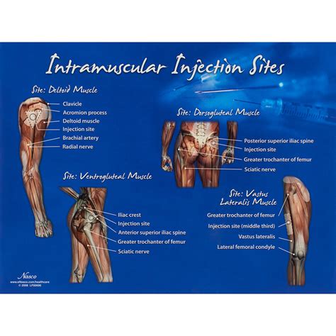 Intramuscular Injection Sites Chart – Nasco Healthcare