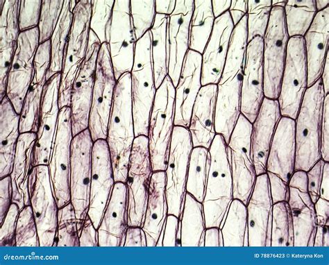 Cells Of An Onion Root Tip Undergo Mitosis. Anaphases And Metaphases Under Microscope Stock ...