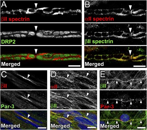 Schwann cell spectrins modulate peripheral nerve myelination | PNAS