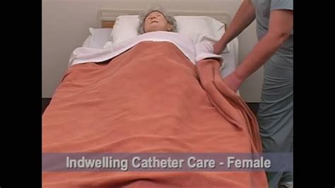 CNA 17 Indwelling Catheter Care - YouTube