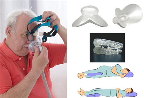 Alternatives to CPAP treatment