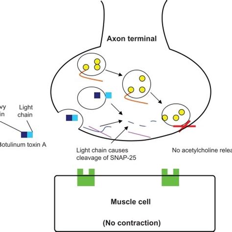 Mechanism of action of botulinum toxin type A. | Download Scientific Diagram