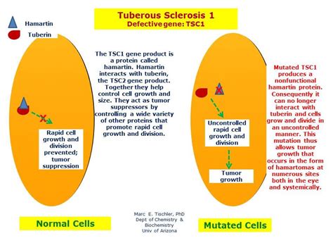 Tuberous sclerosis, Genetic disorders, Pathology