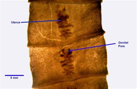 Diphyllobothrium species - Learn About Parasites - Western College of ...