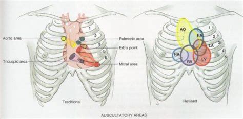 The cardiac examination: Cardiac Auscultation | Cardiac auscultation ...