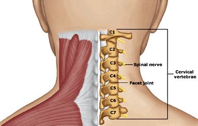 Cervical Strain - A Common Initial Diagnosis For Neck Pain