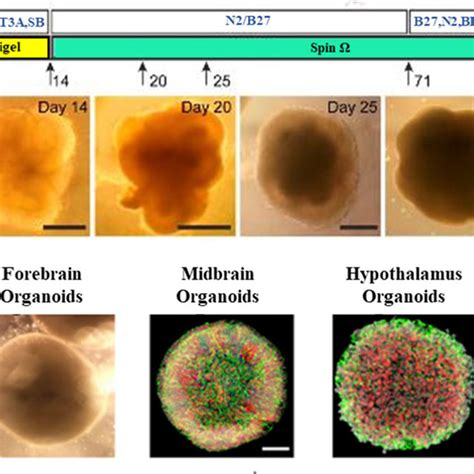 Three-dimensional brain organoid models. Advances in culture ...