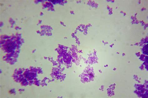 Staphylococcus Aureus Under A Microscope