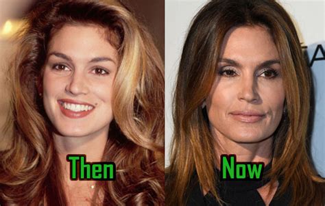 Cindy Crawford: Plastic Surgery Is Her Beauty Secret! Before-After! - CelebritySurgeryIcon