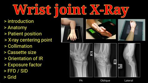 X Ray Wrist Lateral View