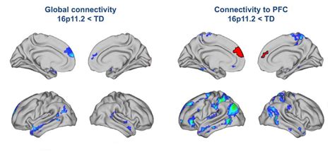 Chromosome 16 deletion miswires brain in people, mice | Spectrum | Autism Research News