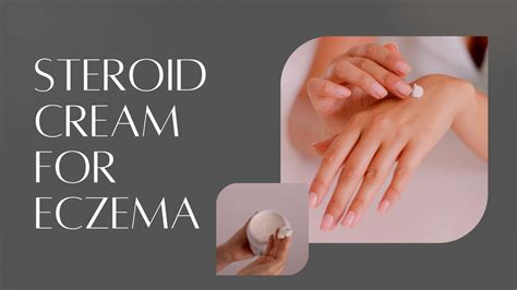 Steroid cream for Eczema | Eczemaless