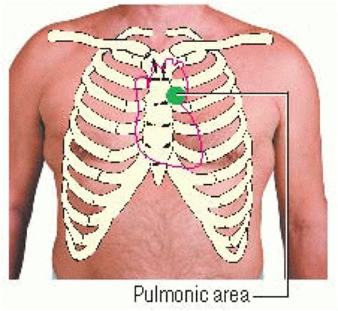 Systolic Murmurs | Thoracic Key